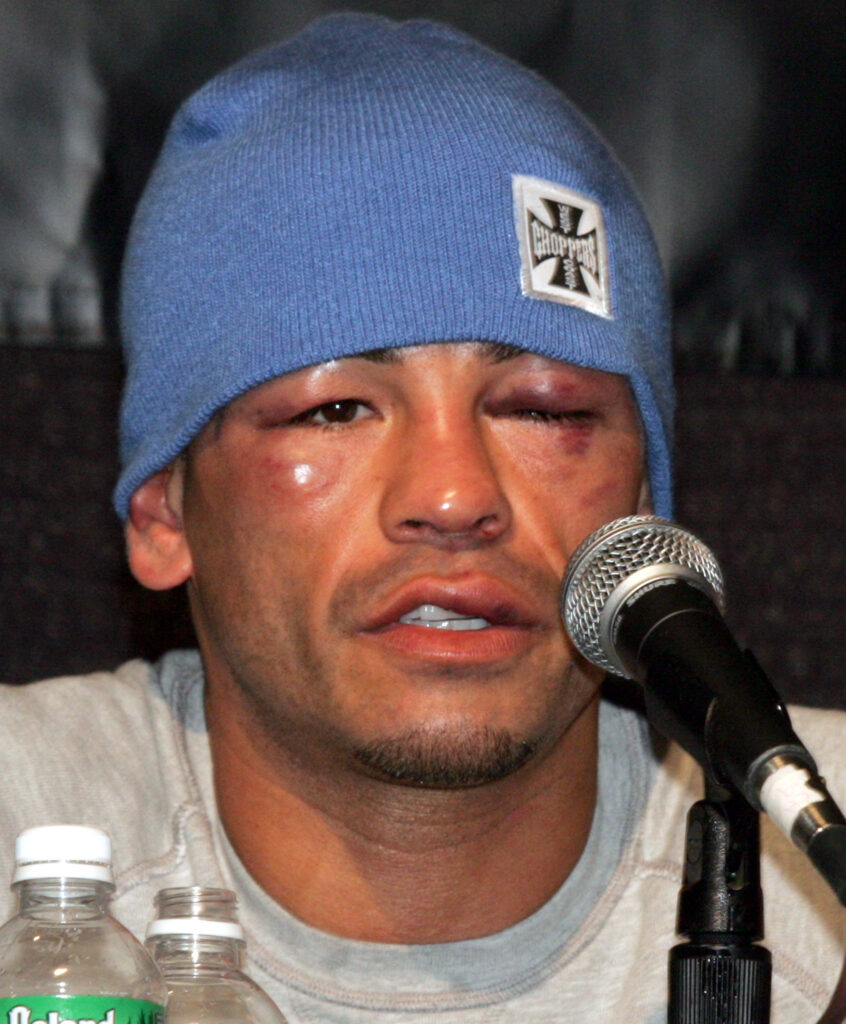 Arturo Gatti after Mayweather fight