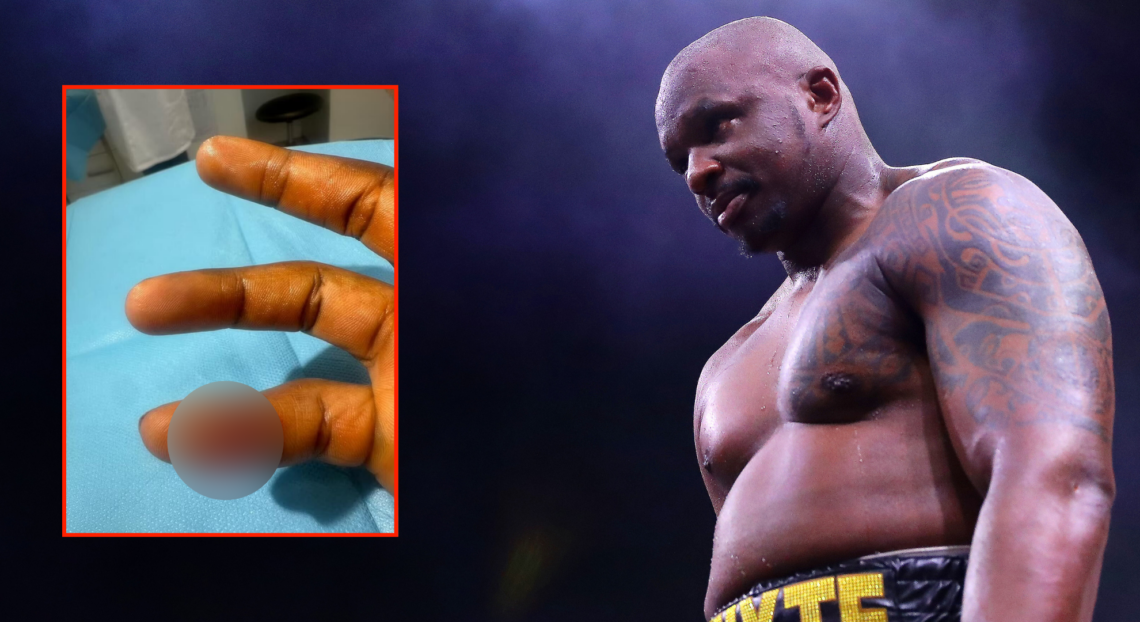 Dillian Whyte reacts after defeating Mariusz Wach, inset Whyte's lacerated finger.