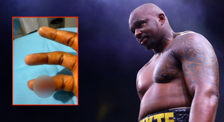 Dillian Whyte reacts after defeating Mariusz Wach, inset Whyte's lacerated finger.