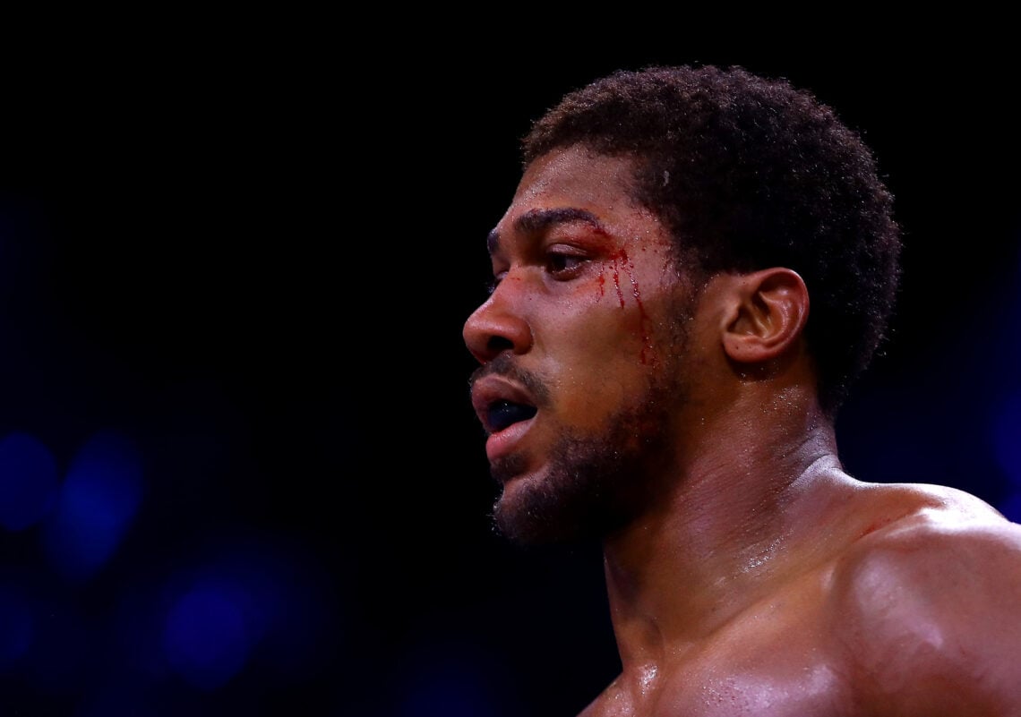 Photo by Richard Heathcote/Getty Images