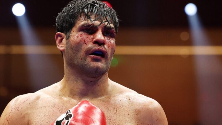 Close-up of Filip Hrgovic with cuts above both eyes during his fight with Daniel Dubois